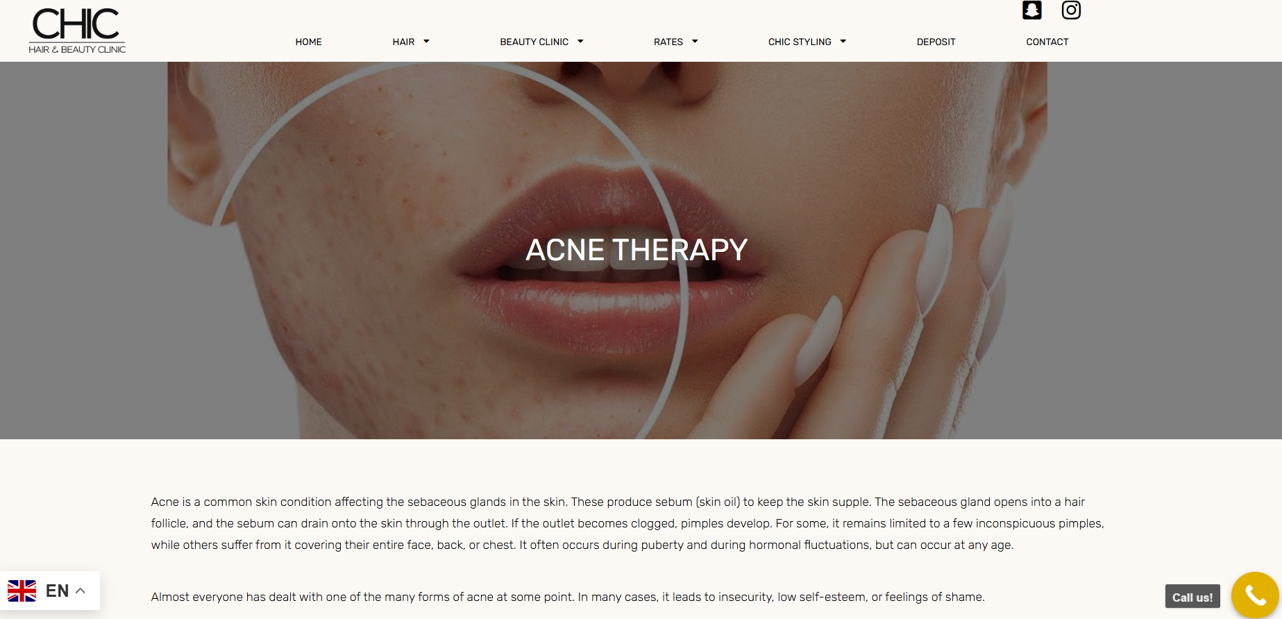 UX UI design for beauty clinic website showing acne therapy service page with skincare information